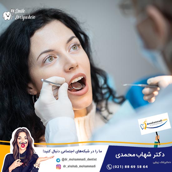 با بهترین برندهای لمینت دندان آمریکایی آشنا شوید - کلینیک دندانپزشکی دکتر شهاب محمدی
